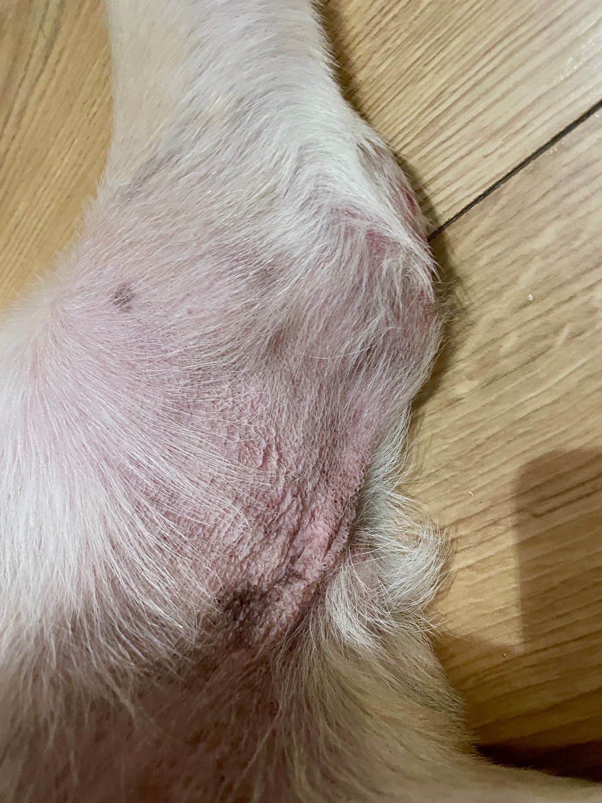 Sara with Calcinosis Cutis