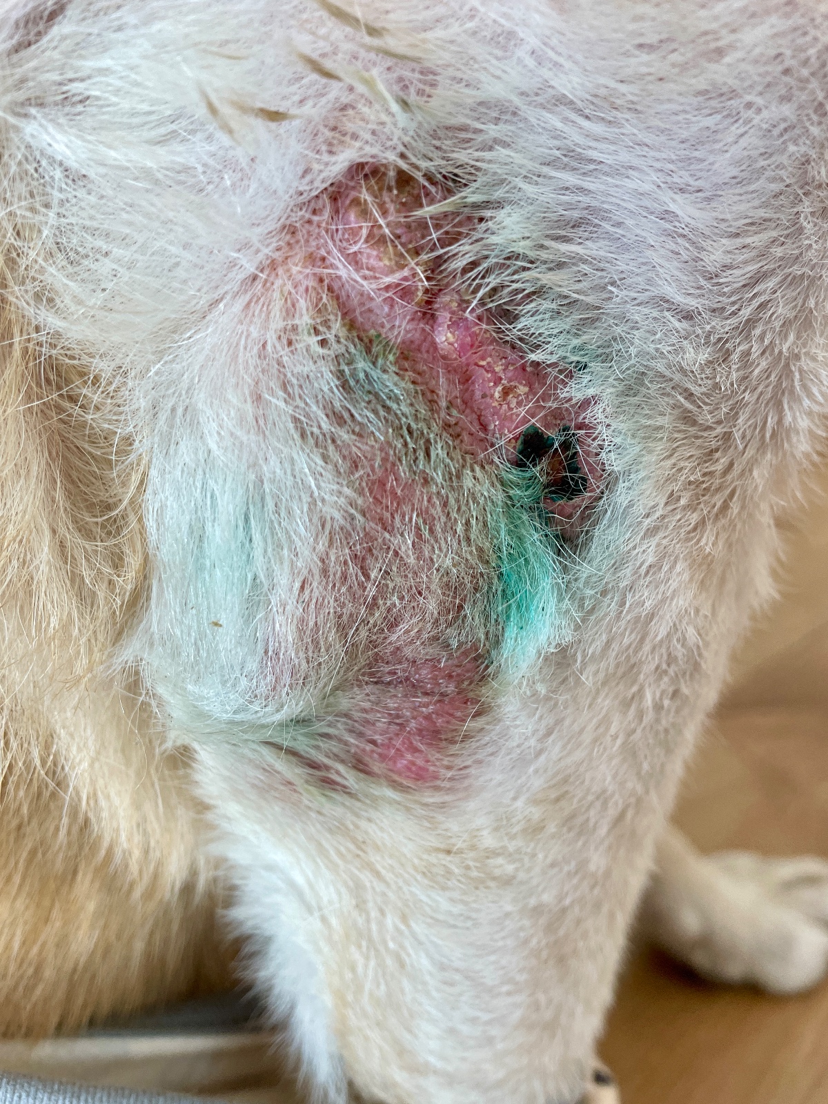 Sara with Calcinosis Cutis