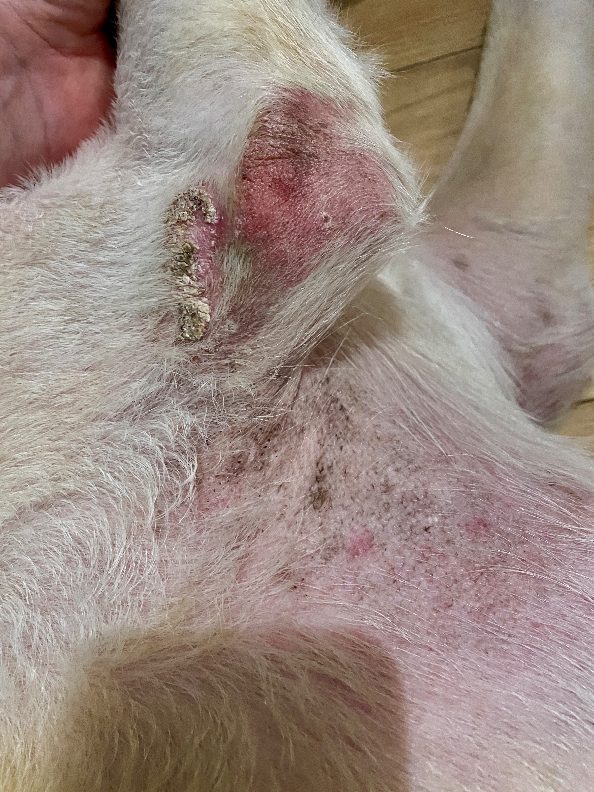 Sara with Calcinosis Cutis